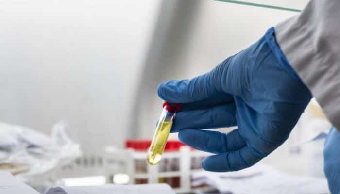 #coronavirus | 113 decese şi 7.095 de infectări raportate în ultimele 24 de ore în România