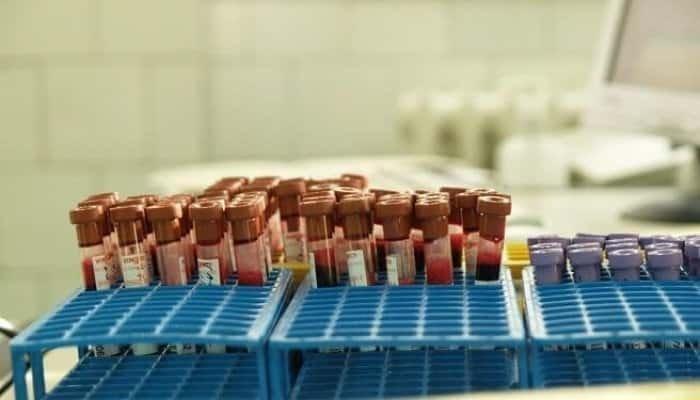 Aproape 3.000 de persoane din sudul țării au fost depistate cu virusul hepatitic B sau C, în cadrul programului LIVE(RO)2-SUD