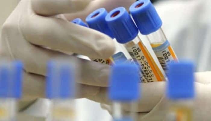 pachet gratuit analize laborator